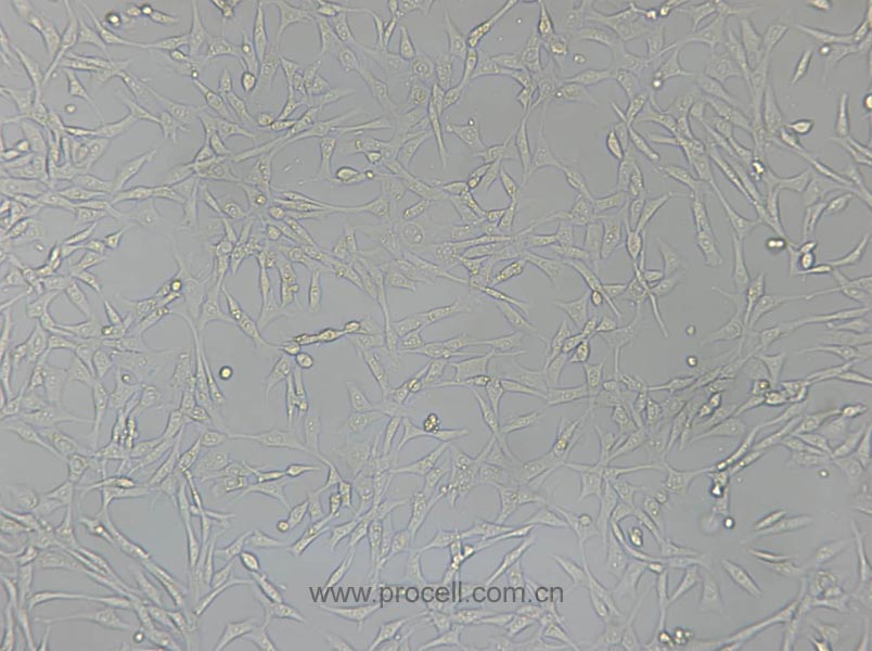 PA317 (小鼠成纖維細(xì)胞)(暫不出售)