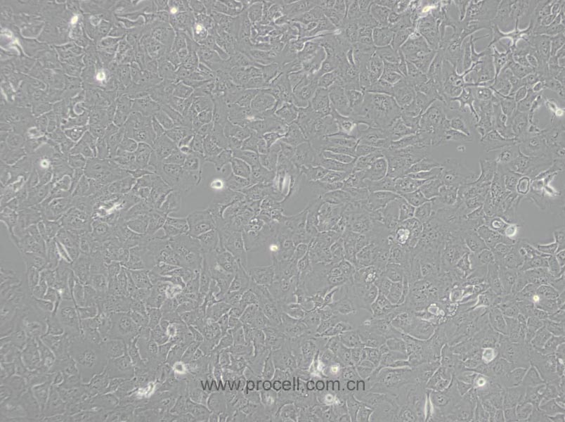 RBE (人肝膽管癌細(xì)胞) (STR鑒定正確)