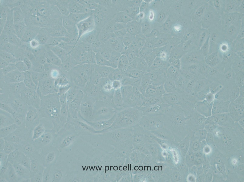 RWPE-1(人正常前列腺上皮細胞)(STR鑒定正確)