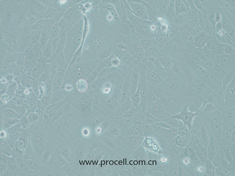 RWPE-1(人正常前列腺上皮細胞)(STR鑒定正確)