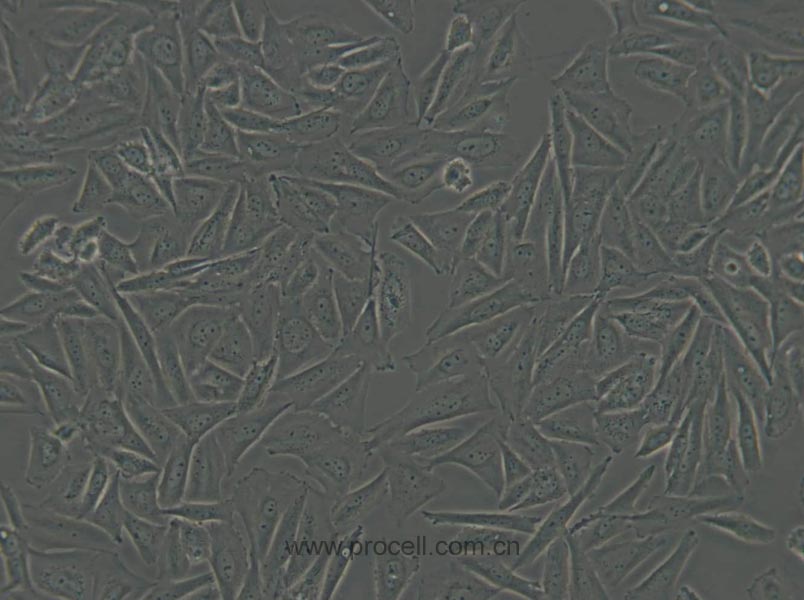 Saos-2 (人成骨肉瘤細(xì)胞) (STR鑒定正確)