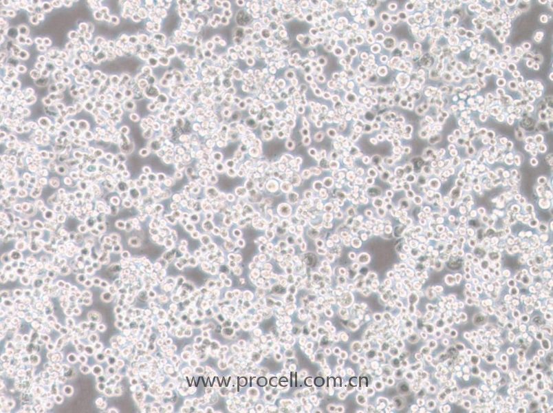 Sf21 (昆蟲卵巢細(xì)胞) (種屬鑒定正確)