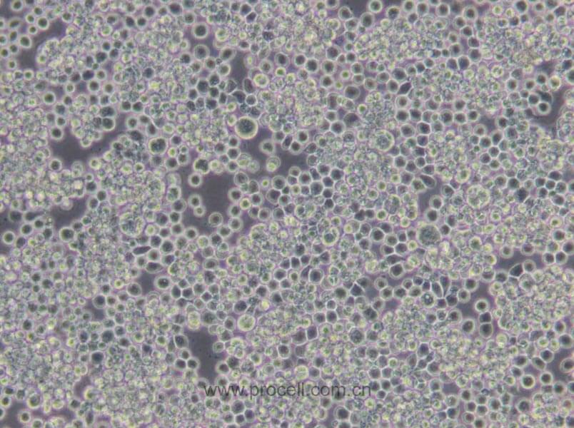 Sf9 (昆蟲卵巢細(xì)胞) (種屬鑒定正確)