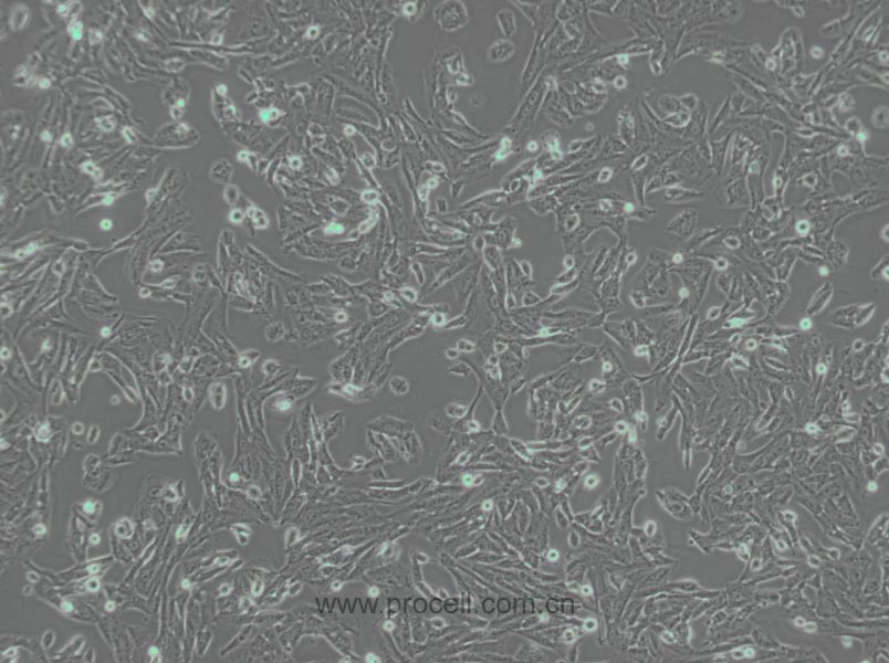 SK-N-SH (人神經(jīng)母細胞瘤細胞) (STR鑒定正確)