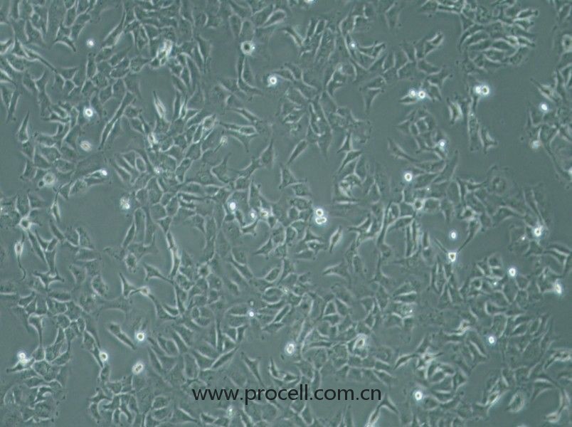 SK-OV-3 (人卵巢癌細(xì)胞) (STR鑒定正確)