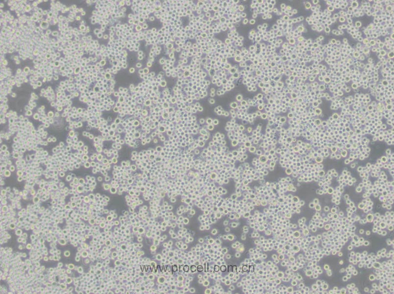 SP2/0(小鼠骨髓瘤細(xì)胞)