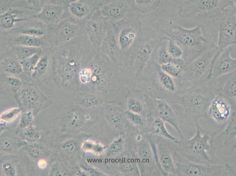 SVEC4-10 (小鼠淋巴結(jié)內(nèi)皮細胞) (STR鑒定正確)