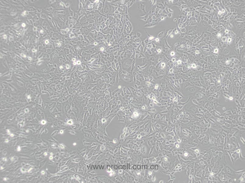 SV-HUC-1 (人輸尿管上皮永生化細(xì)胞) (STR鑒定正確)