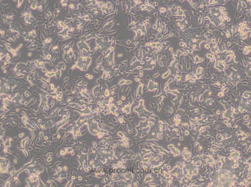 SW480 [SW-480] (人結(jié)腸癌細(xì)胞) (STR鑒定正確)