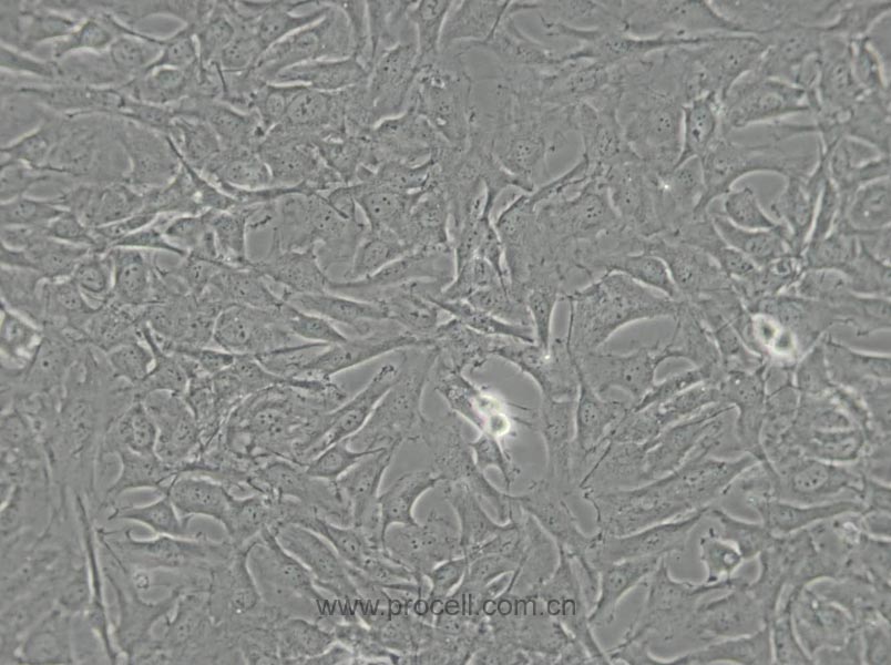SW579 [SW 579; SW-579] (人甲狀腺鱗癌細(xì)胞) (STR鑒定正確)
