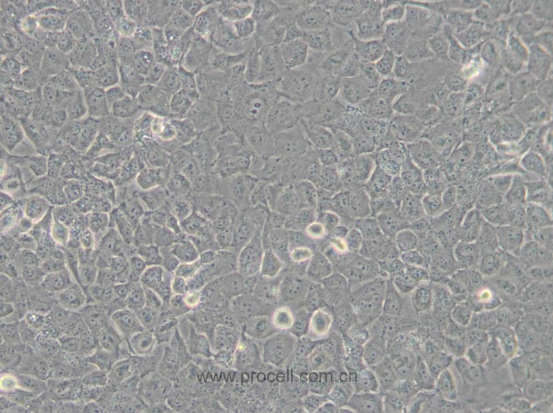 T24 [T-24] (人膀胱移行細(xì)胞癌細(xì)胞) (STR鑒定正確)