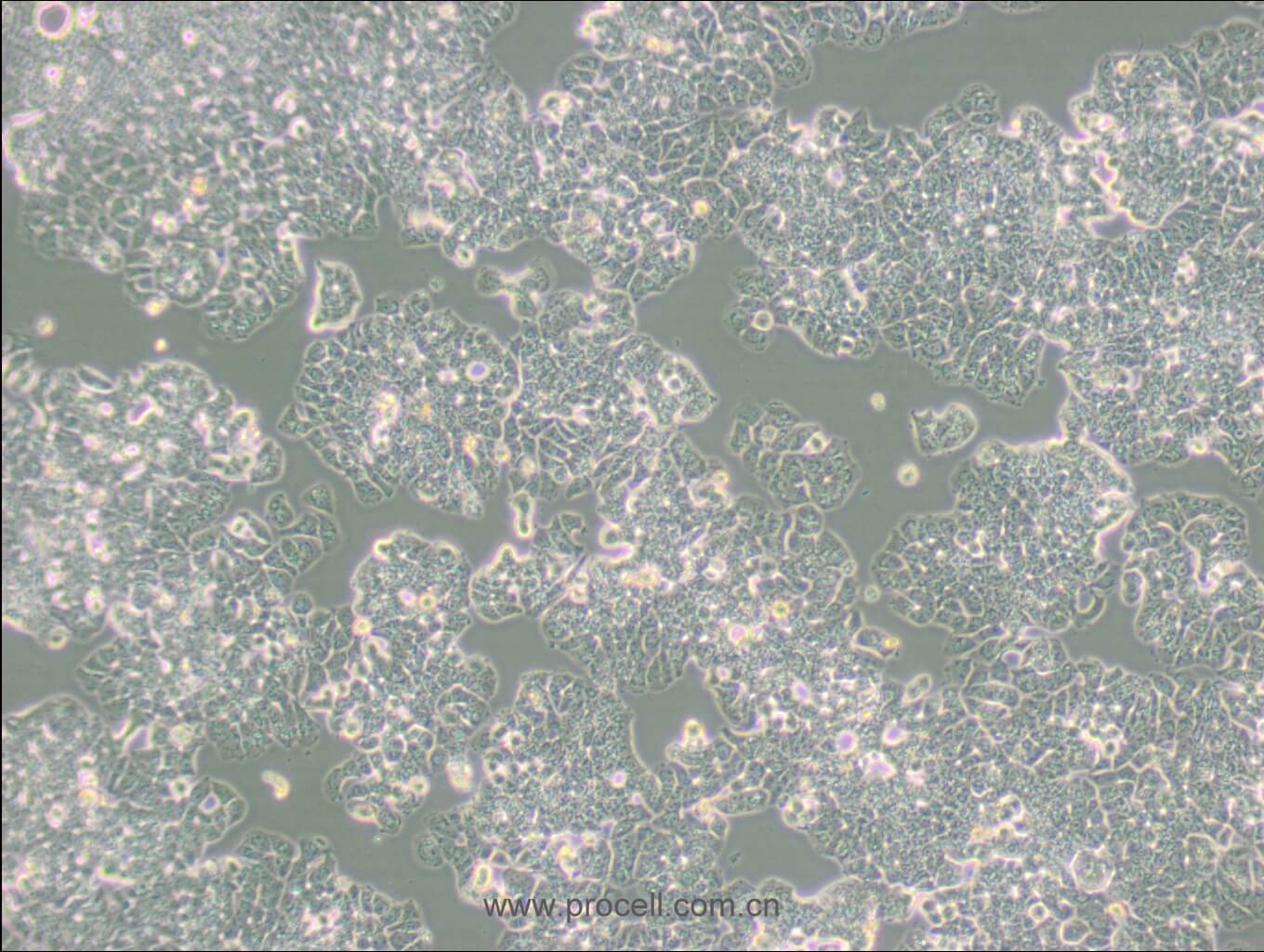 T-47D (人乳腺管癌細胞) (STR鑒定正確)
