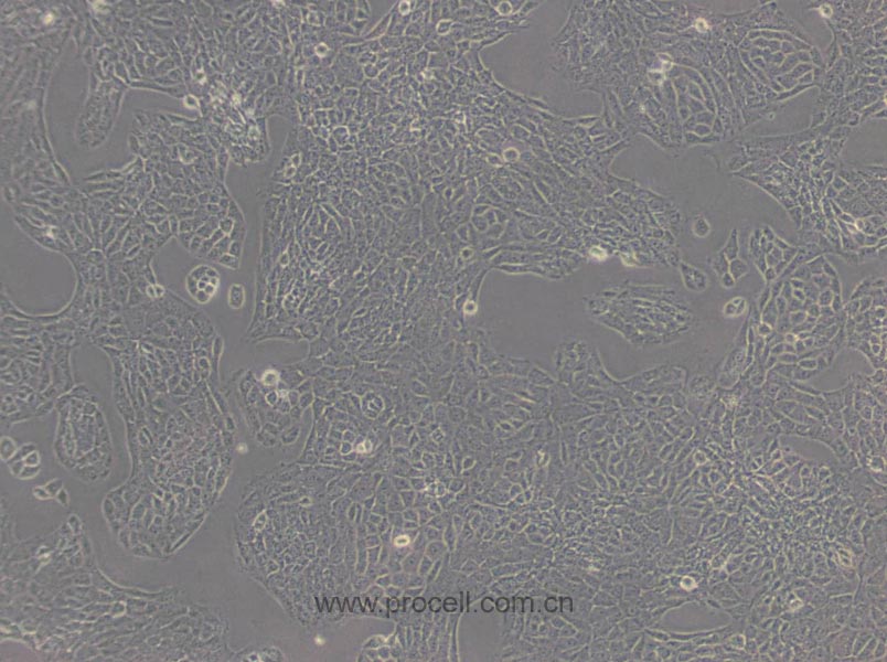 TM3 (小鼠睪丸間質(zhì)細胞) (STR鑒定正確)
