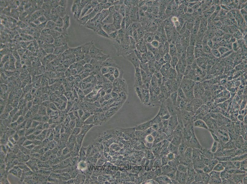 TM3 (小鼠睪丸間質(zhì)細胞) (STR鑒定正確)