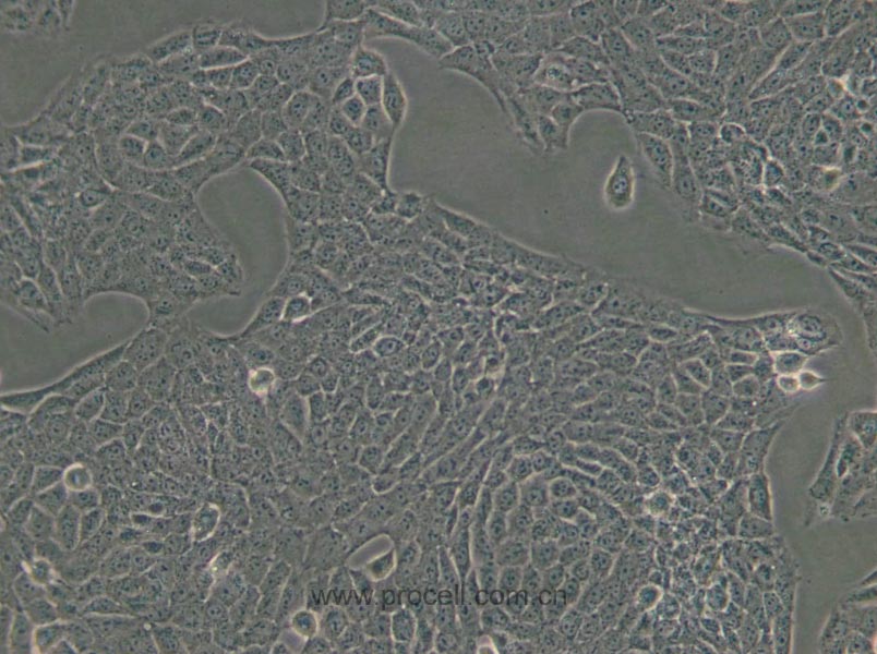 TM3 (小鼠睪丸間質(zhì)細胞) (STR鑒定正確)