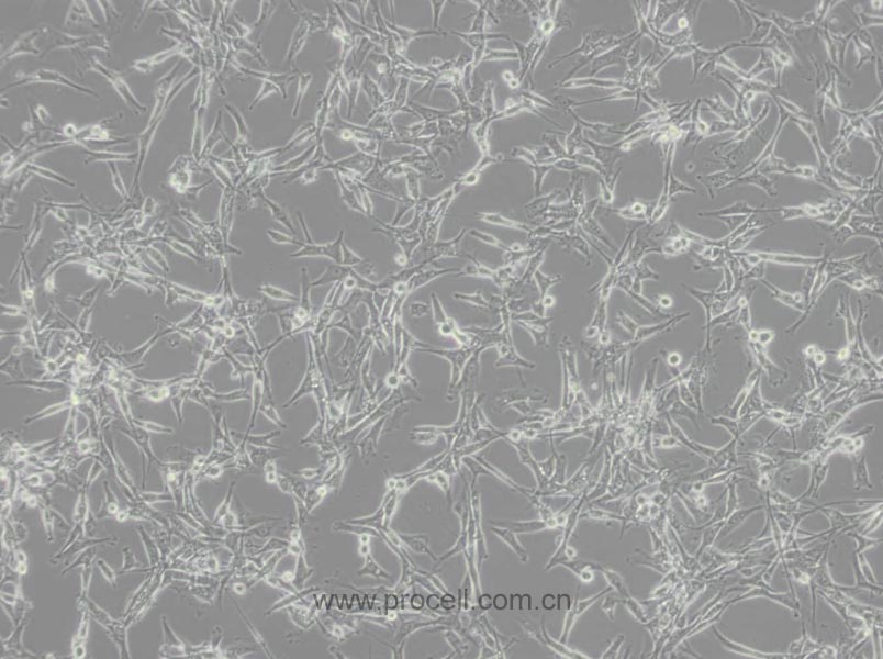 U-87 MG (人腦星形膠質(zhì)母細胞瘤細胞) (STR鑒定正確)