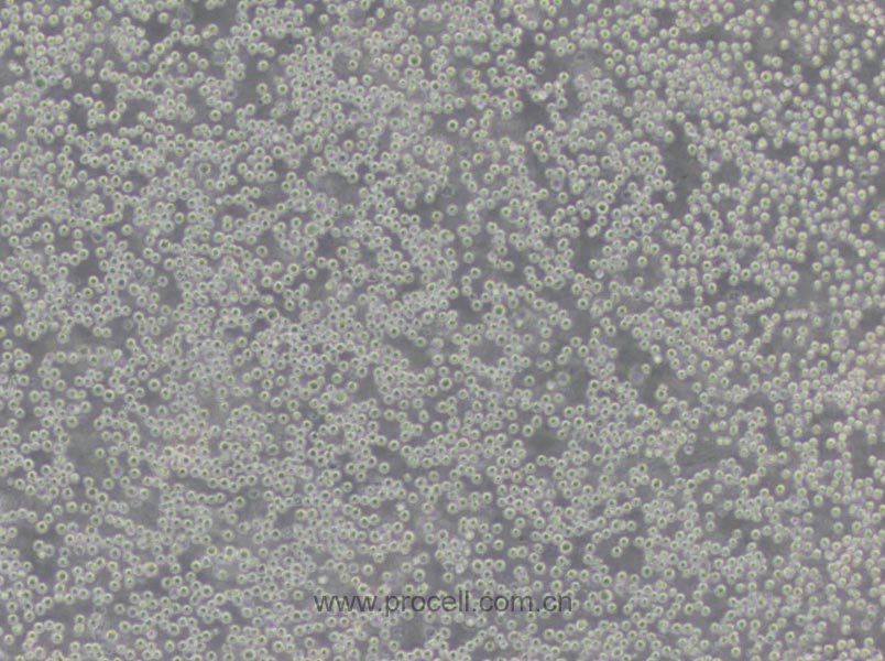 U-937 (人組織細(xì)胞淋巴瘤細(xì)胞) (STR鑒定正確)