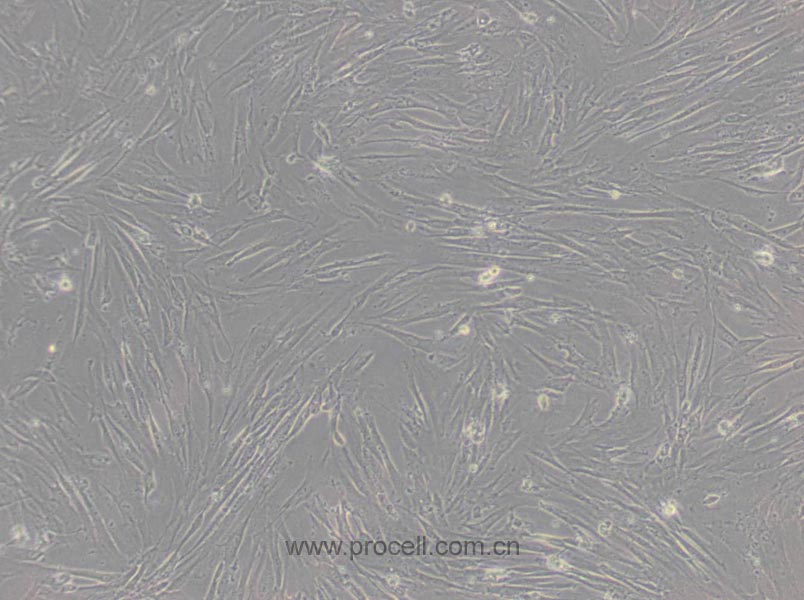 WI-38 (人胚肺細(xì)胞) (STR鑒定正確)