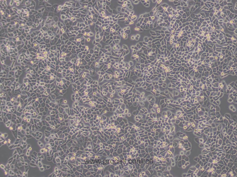 MDA-MB-468 (人乳腺癌細胞) (STR鑒定正確)