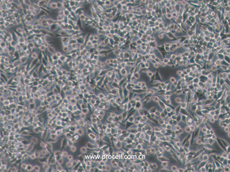 MKN-45 (人胃癌細(xì)胞)(STR鑒定正確)