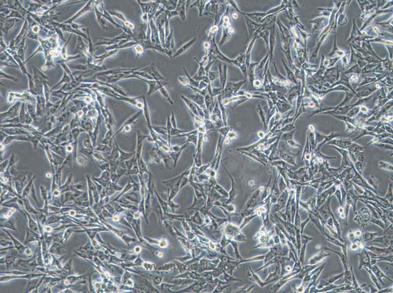 NCI-H1975 (人肺腺癌細(xì)胞) (STR鑒定正確)