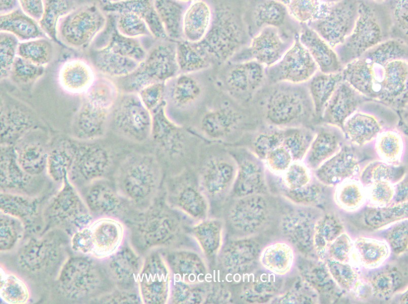 NCI-H661 (人大細(xì)胞肺癌細(xì)胞) (STR鑒定正確)