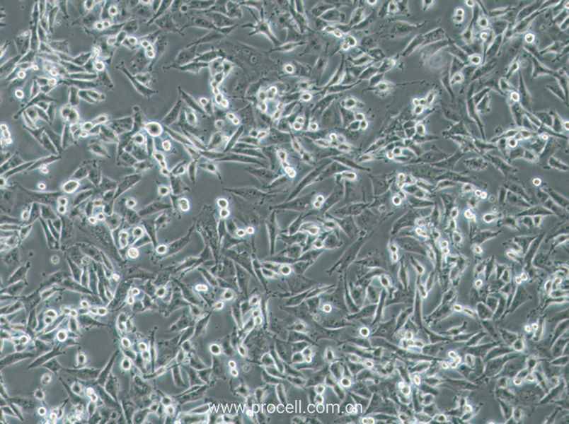 SF-295 (人XG惡性膠質(zhì)瘤細胞) (STR鑒定正確)