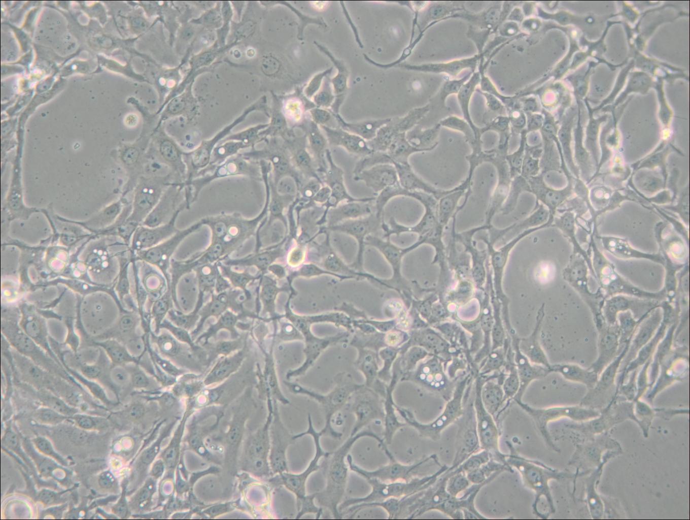 BT-20 (人乳腺癌細(xì)胞) (STR鑒定正確)