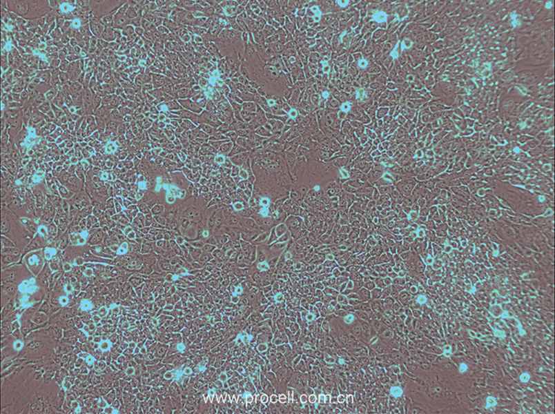 HPAC (人胰腺腺泡上皮癌) (STR鑒定正確)