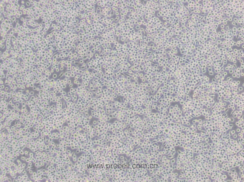 J774A.1 (小鼠單核巨噬細胞) (STR鑒定正確)