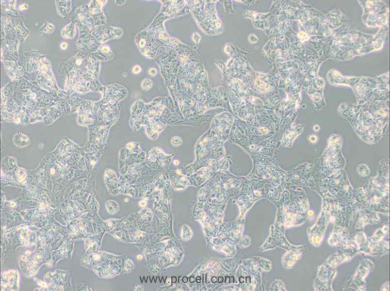 MDA-MB-175VII (人乳腺導(dǎo)管癌細(xì)胞) (STR鑒定正確)