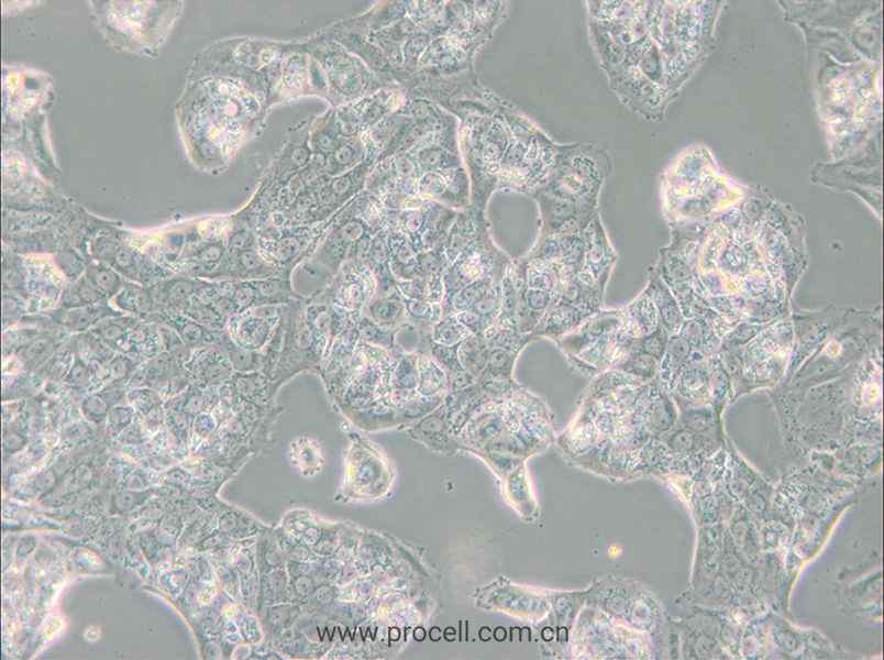 MDA-MB-175VII (人乳腺導(dǎo)管癌細(xì)胞) (STR鑒定正確)