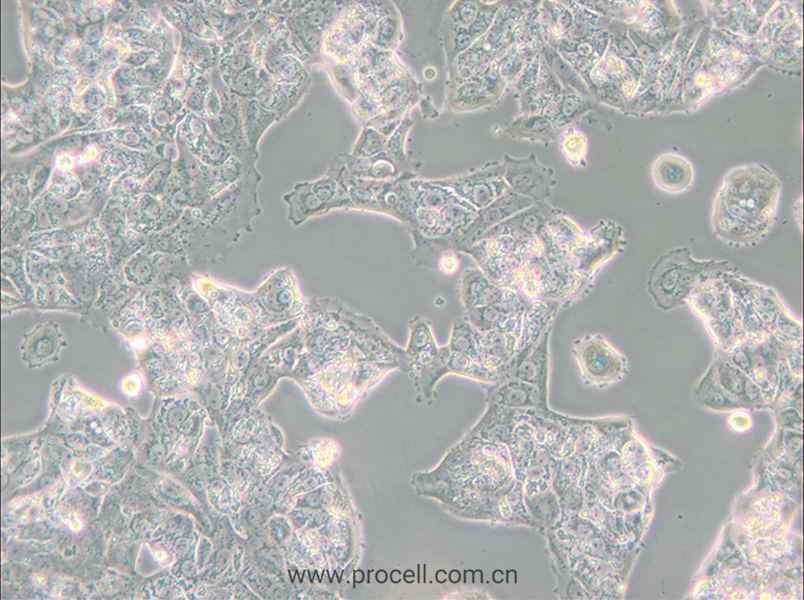 MDA-MB-175VII (人乳腺導(dǎo)管癌細(xì)胞) (STR鑒定正確)