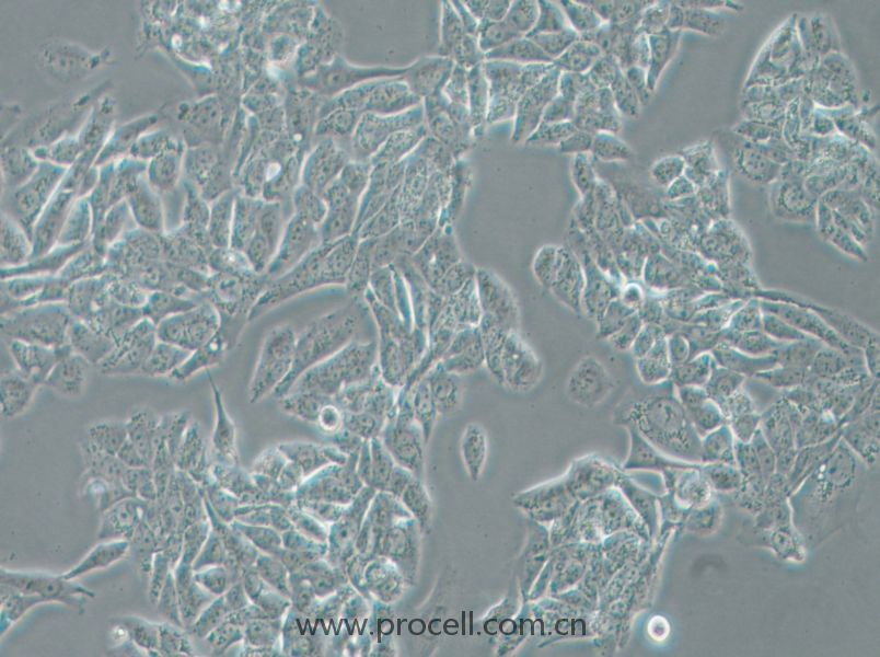 NCI-H358 (人非小細(xì)胞肺癌細(xì)胞) (STR鑒定正確)