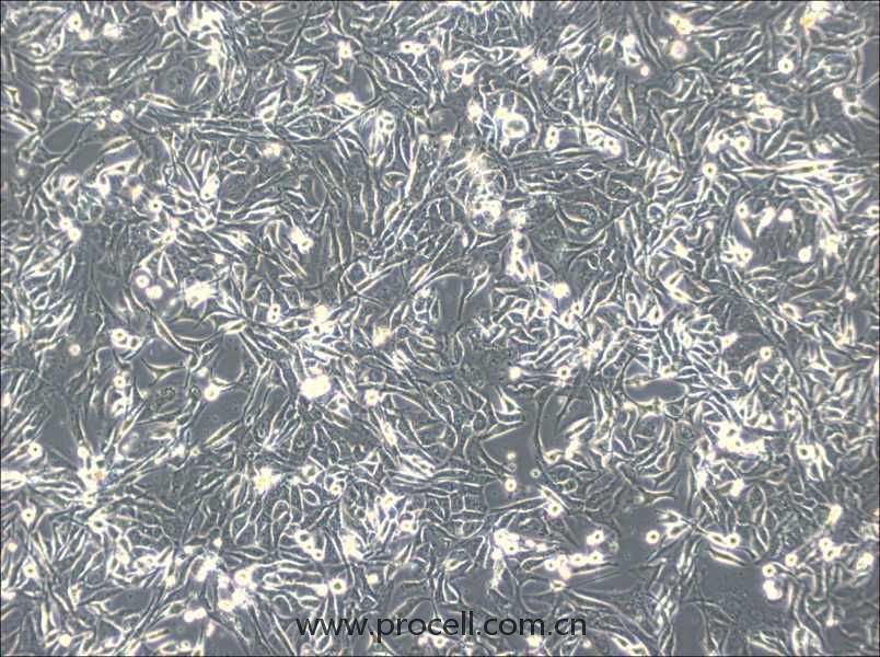 NCI-H596 (人肺腺鱗癌細胞) (STR鑒定正確)