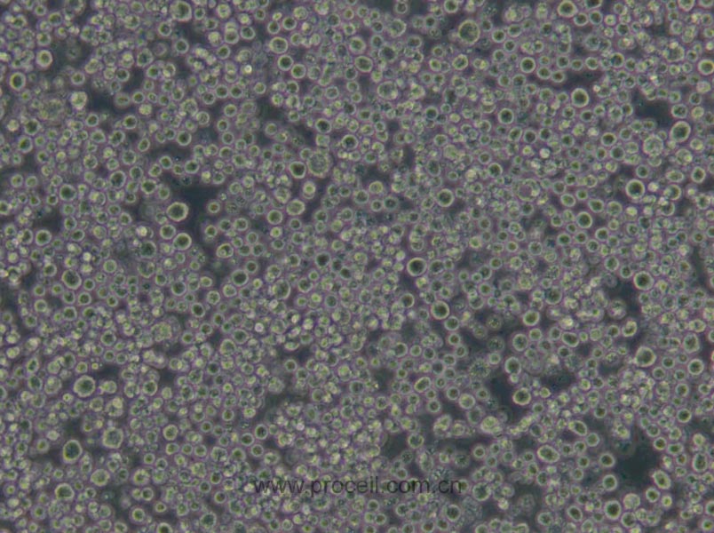 P3X63Ag8.653 (小鼠骨髓瘤細(xì)胞) (STR鑒定正確)