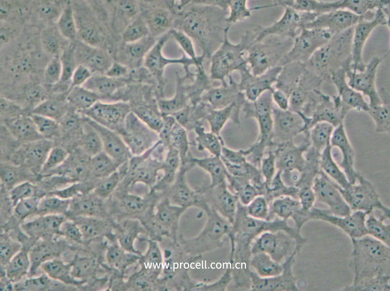 PA-1 (人卵巢畸胎瘤細(xì)胞)(STR鑒定正確)