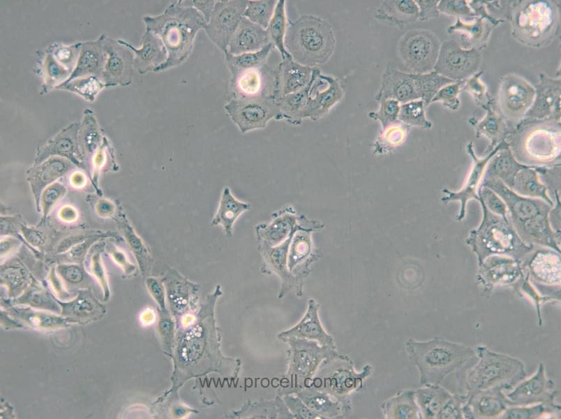 SW 780 [SW-780, SW780] (人膀胱移行細(xì)胞癌) (STR鑒定正確)