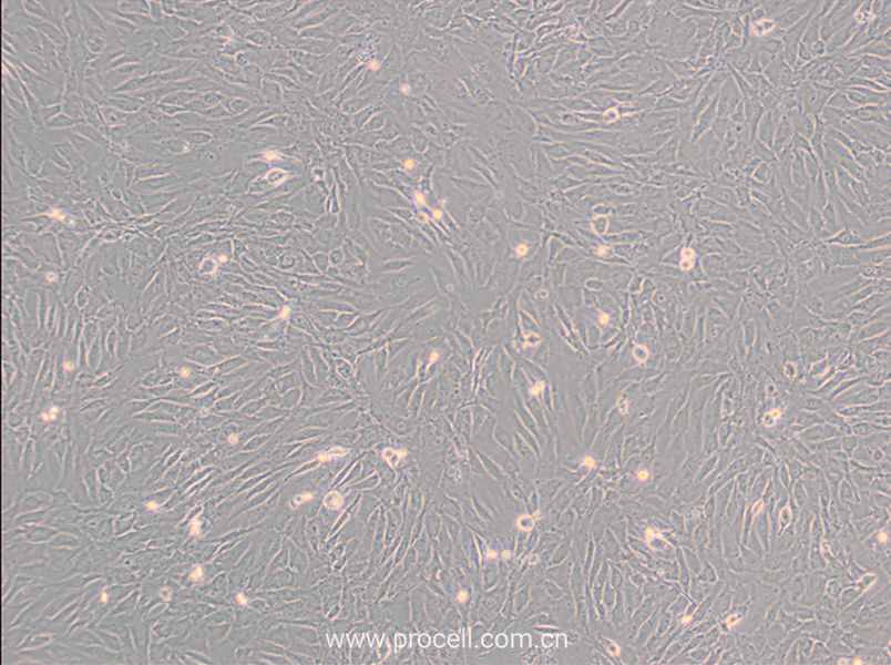 SW 982 [SW-982, SW982] (人滑膜肉瘤細(xì)胞) (STR鑒定正確)