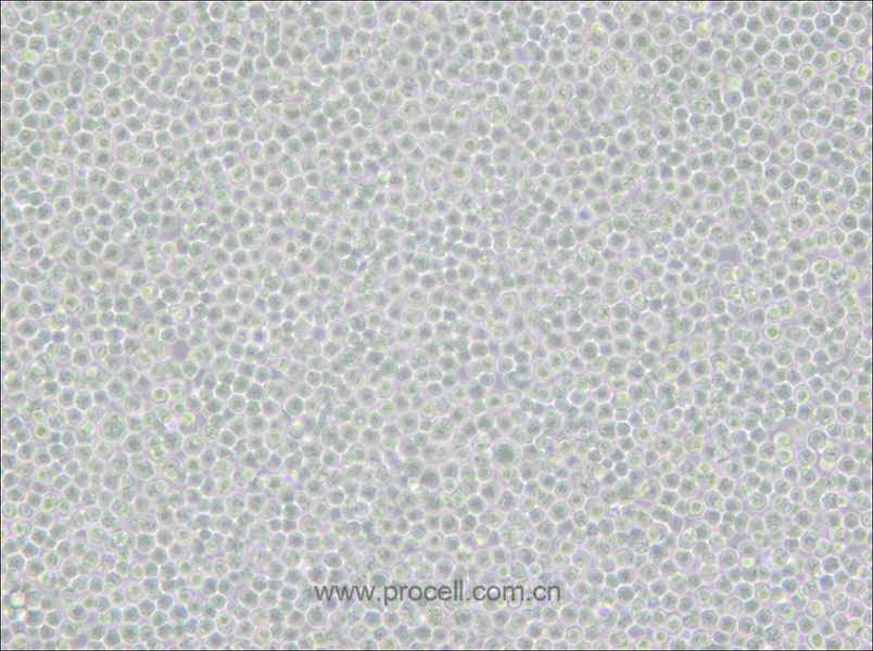 Ramos [RA 1] (人B淋巴細(xì)胞瘤細(xì)胞) (STR鑒定正確)