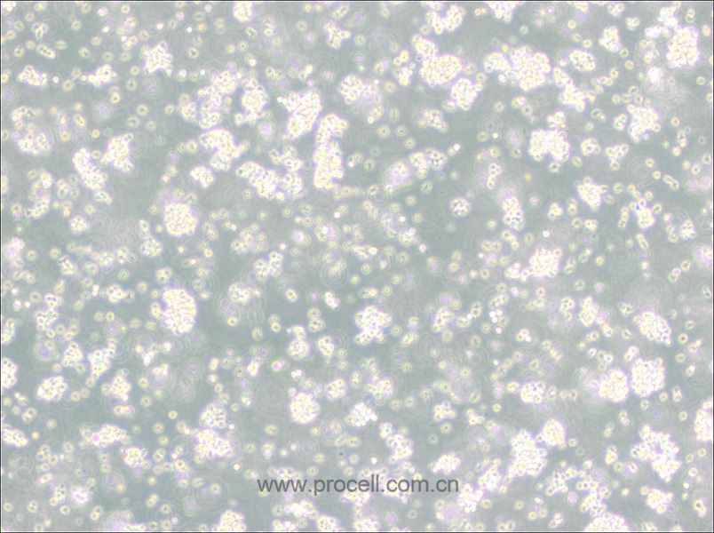 Reh (人急性非B非T淋巴細(xì)胞白血病) (STR鑒定正確)