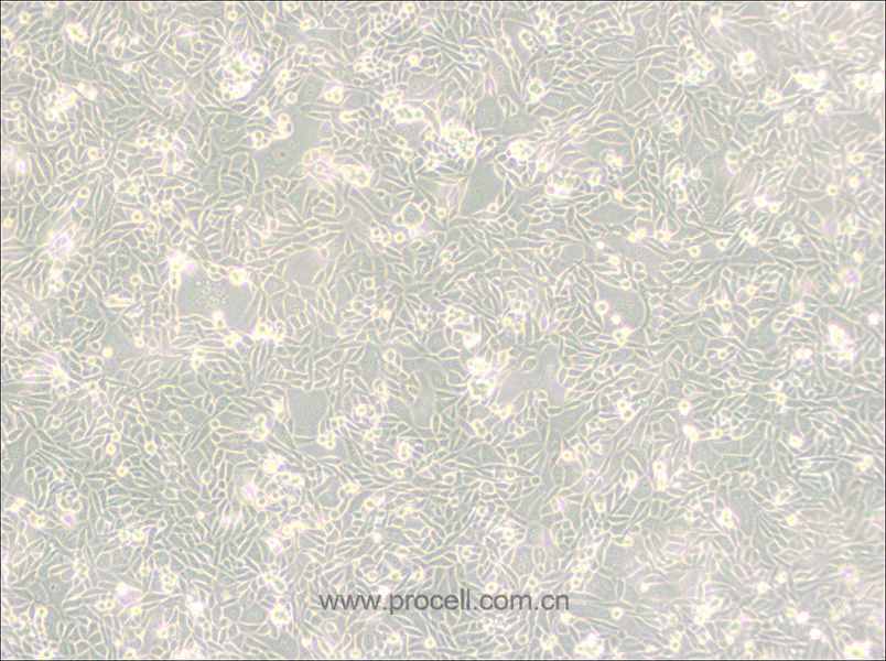 CHO/dhFr- [CHO-DXB11] (倉鼠卵巢細胞(二氫葉酸還原酶缺陷))(種屬鑒定正確)