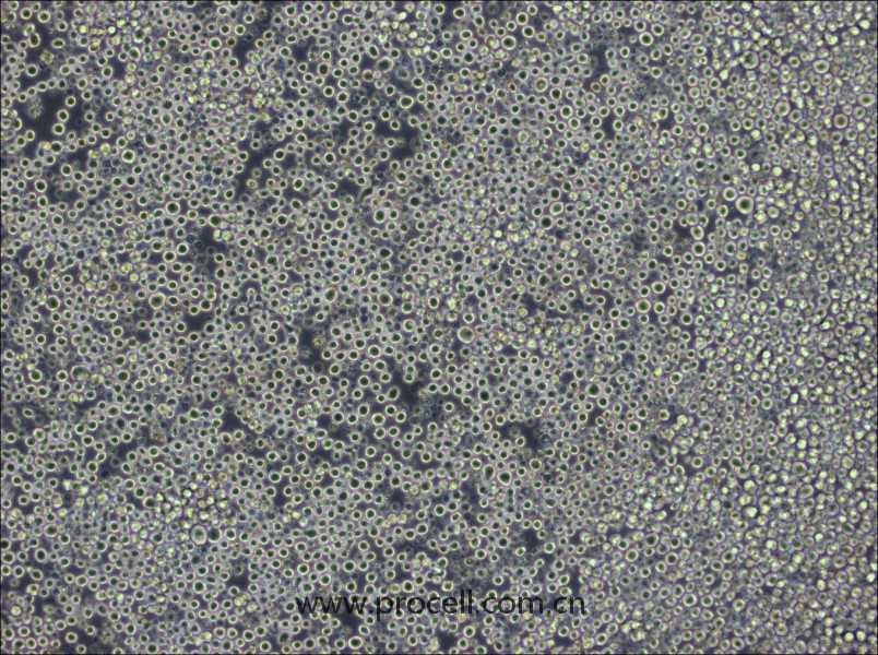 W6/32 (小鼠B細(xì)胞雜交瘤細(xì)胞) (STR鑒定正確)