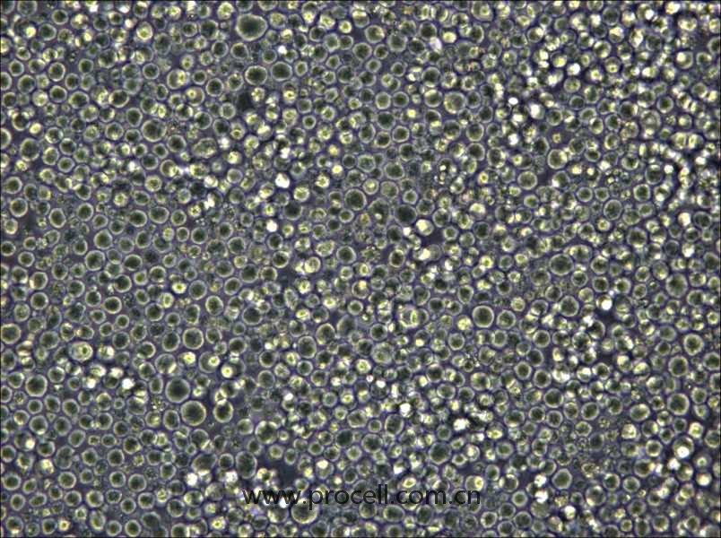 W6/32 (小鼠B細(xì)胞雜交瘤細(xì)胞) (STR鑒定正確)