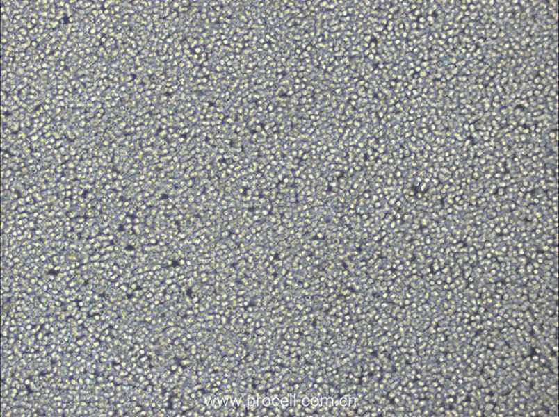 NCI-H929 (人骨髓瘤細胞) (STR鑒定正確)