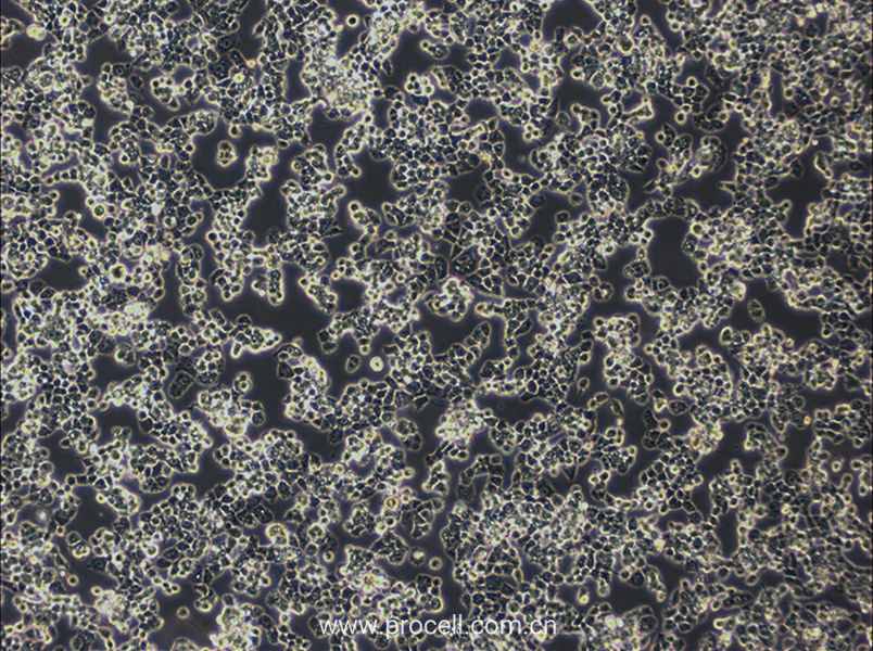 COV434 (人卵巢顆粒腫瘤細胞) (STR鑒定正確)