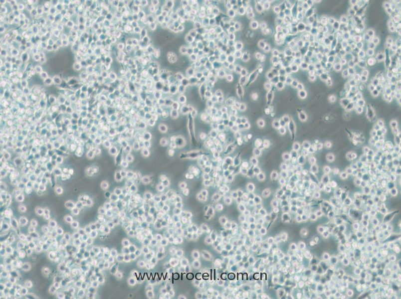 DC2.4 (小鼠骨髓來源樹突狀細(xì)胞) (STR鑒定正確)