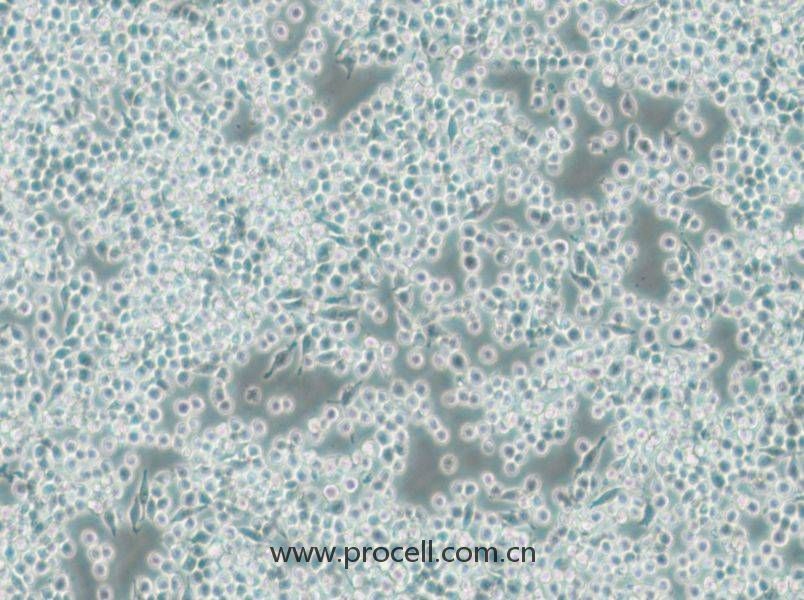 DC2.4 (小鼠骨髓來源樹突狀細(xì)胞) (STR鑒定正確)