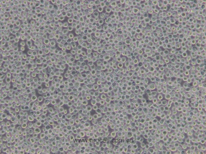 Hi-five (BTI-TN-5B1-4) (昆蟲細(xì)胞)(暫不出售)