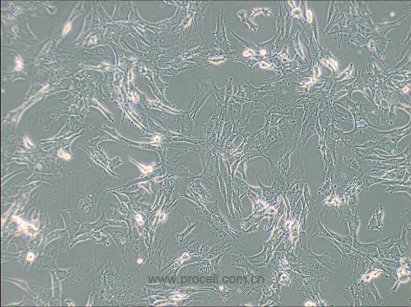 TtT/GF (小鼠垂體促甲狀腺濾泡星狀細胞) (種屬鑒定正確)